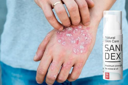 Krema Sanidex za liječenje psorijaze, način primjene, Hrvatska