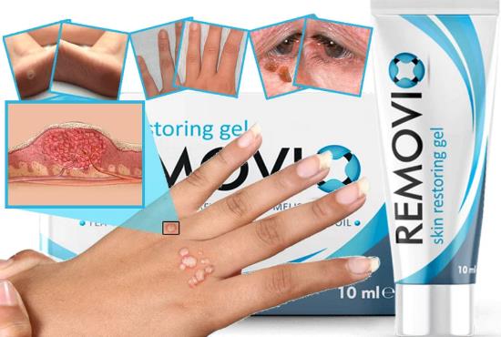 Removio gel prirodni tretman za bradavice i papilome, Hrvatska