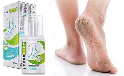 Krema od gljivica stopala Micinorm, način primjene, Hrvatska