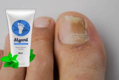 Krema od gljivica stopala Myceril, način primjene, Hrvatska